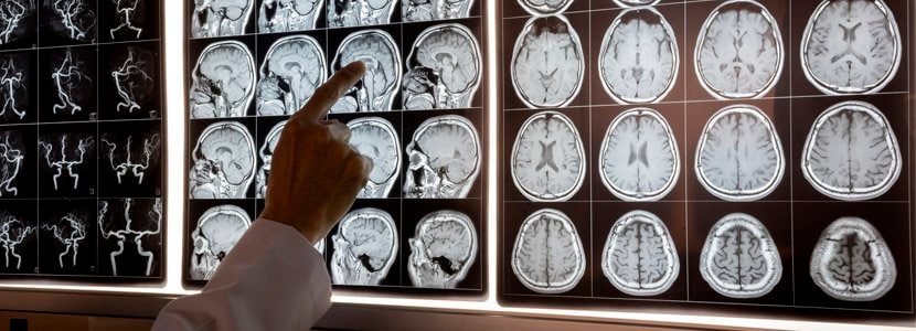 Doctor standing in front of brain scans