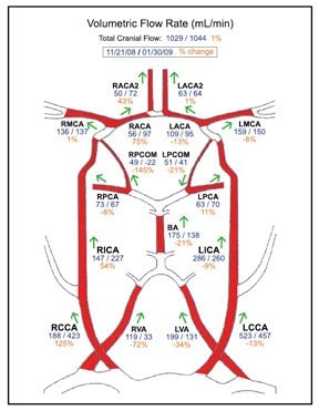 Flow Rate